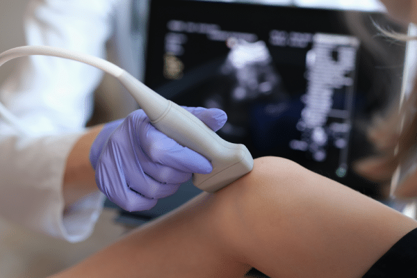 echografie